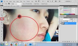 jerawat05.jpg