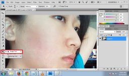 jerawat06.jpg