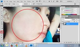 jerawat07.jpg