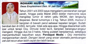 tumor rahim mioma.jpg