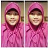 ameliyo